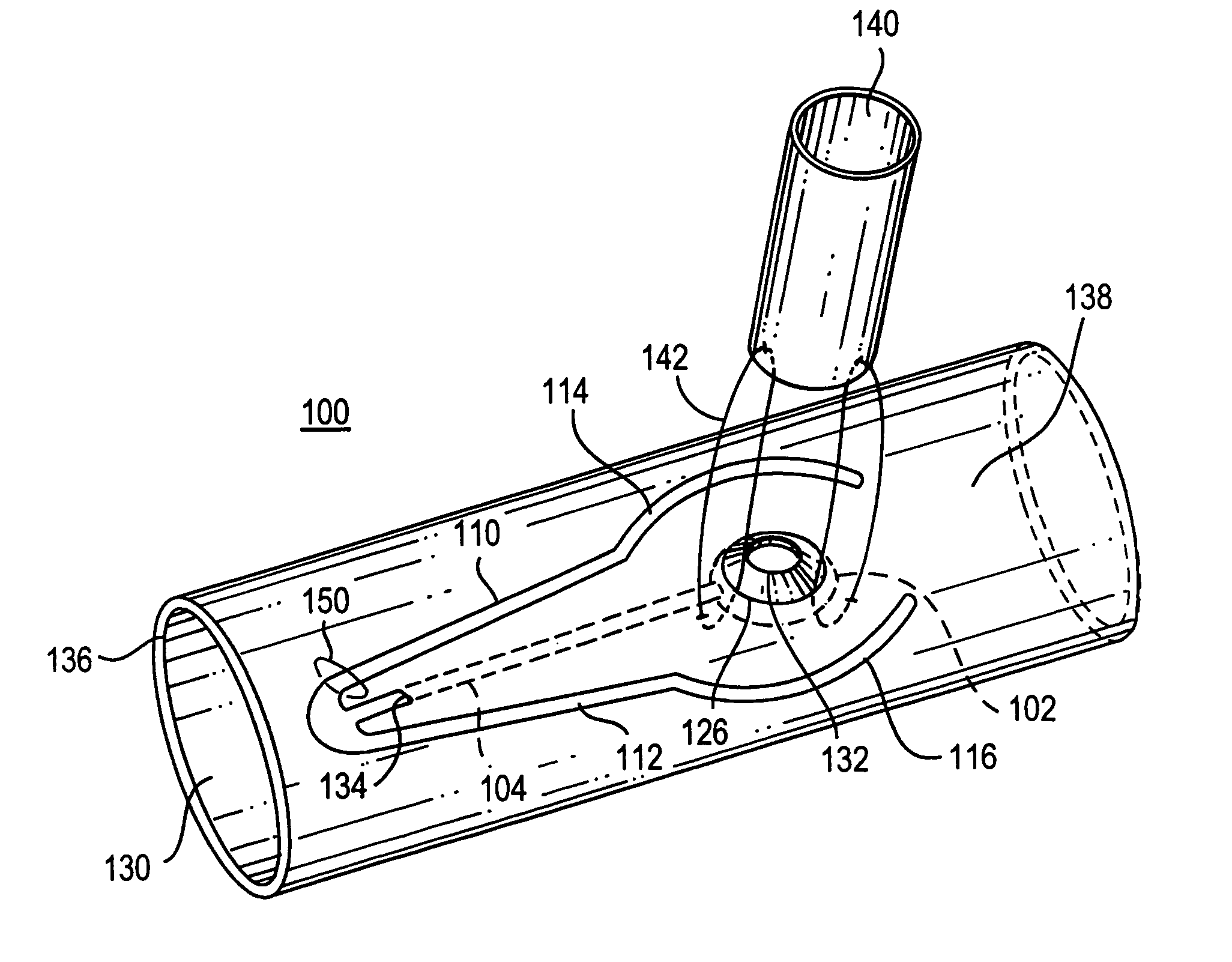 Temporary hemostatic plug apparatus and method of use