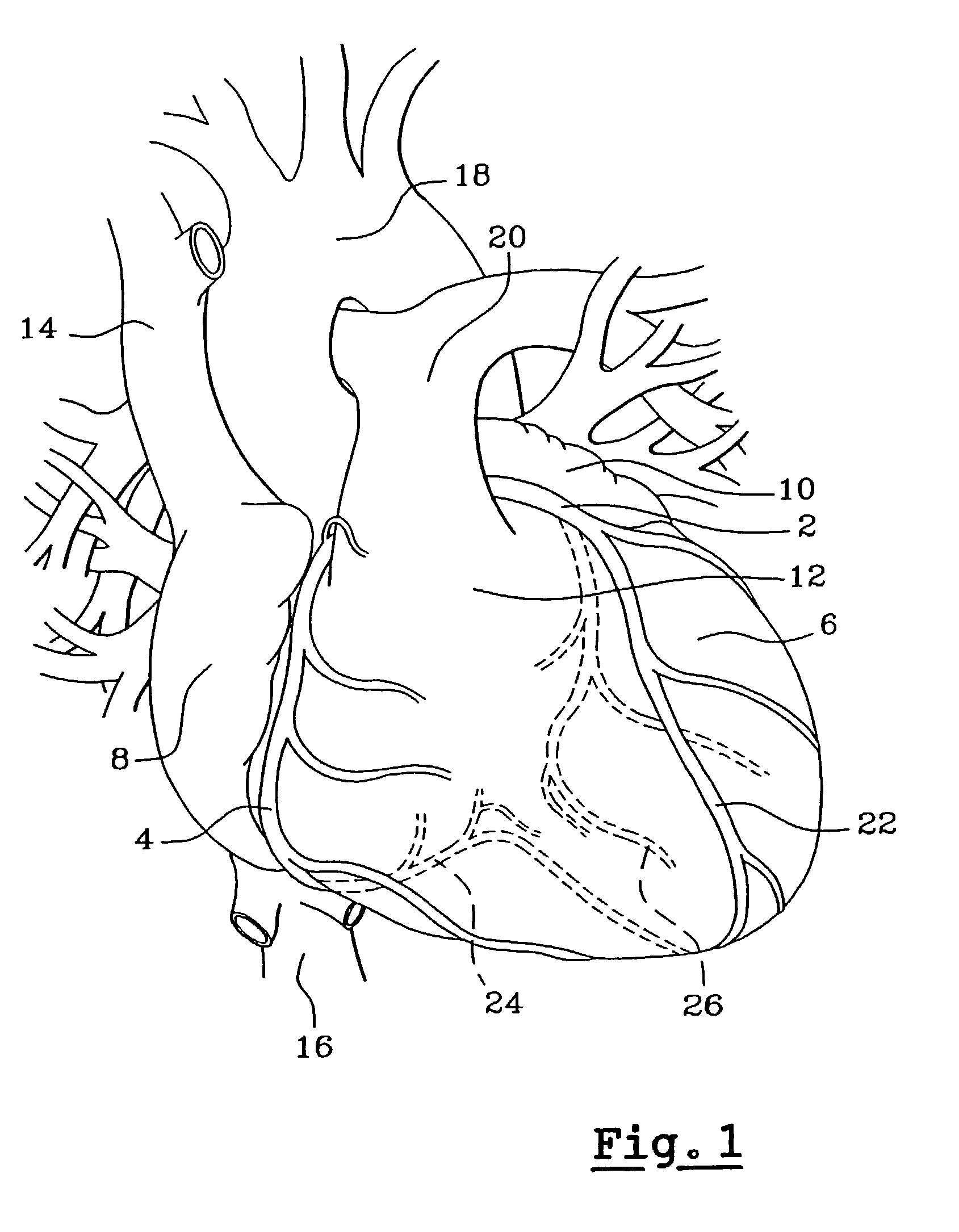 Method and apparatus for cardiac radiological examination in coronary angiography