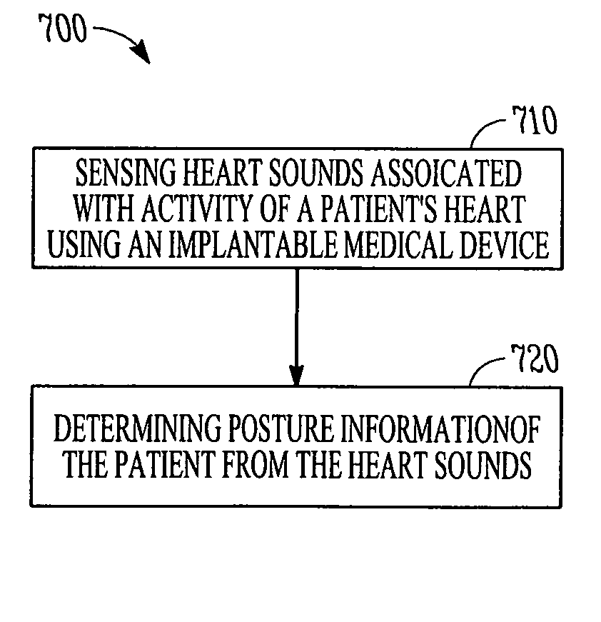 Determining a patient's posture from mechanical vibrations of the heart