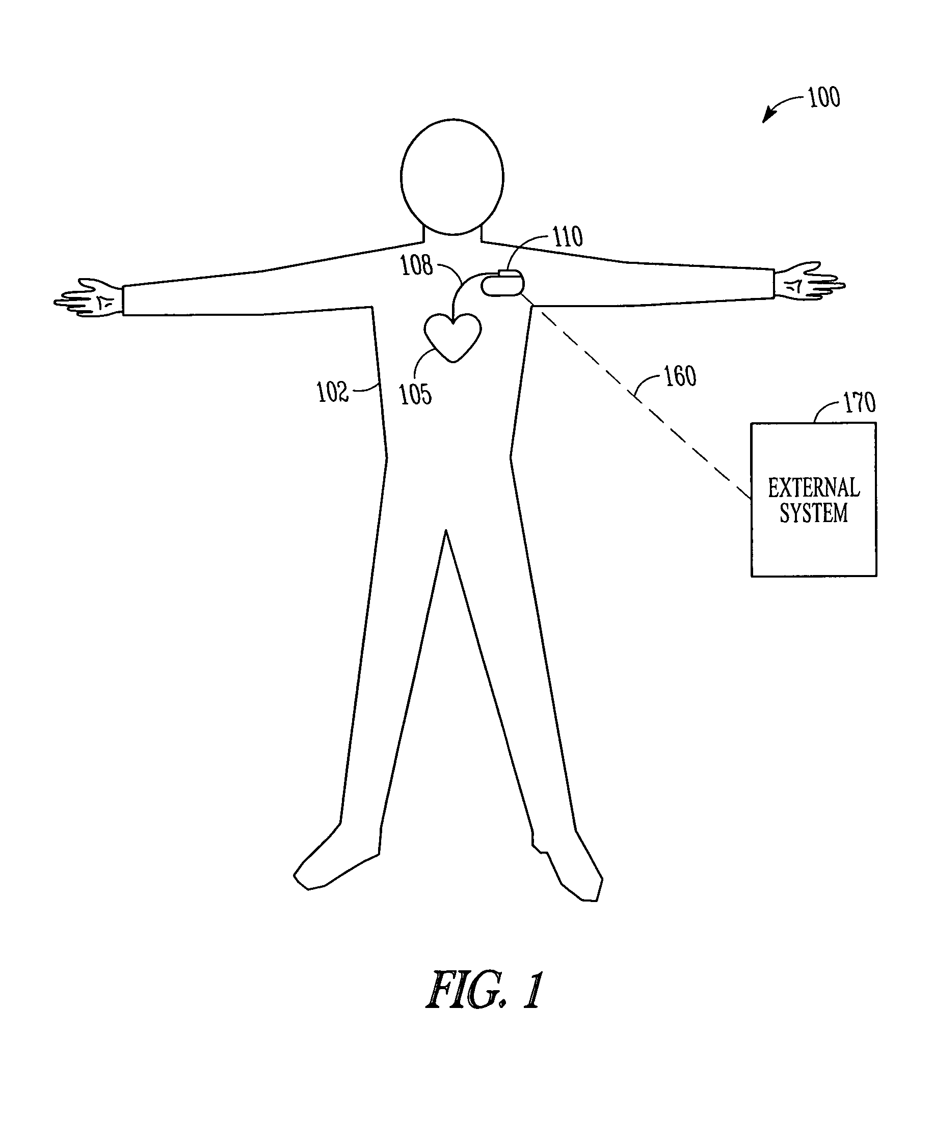 Determining a patient's posture from mechanical vibrations of the heart