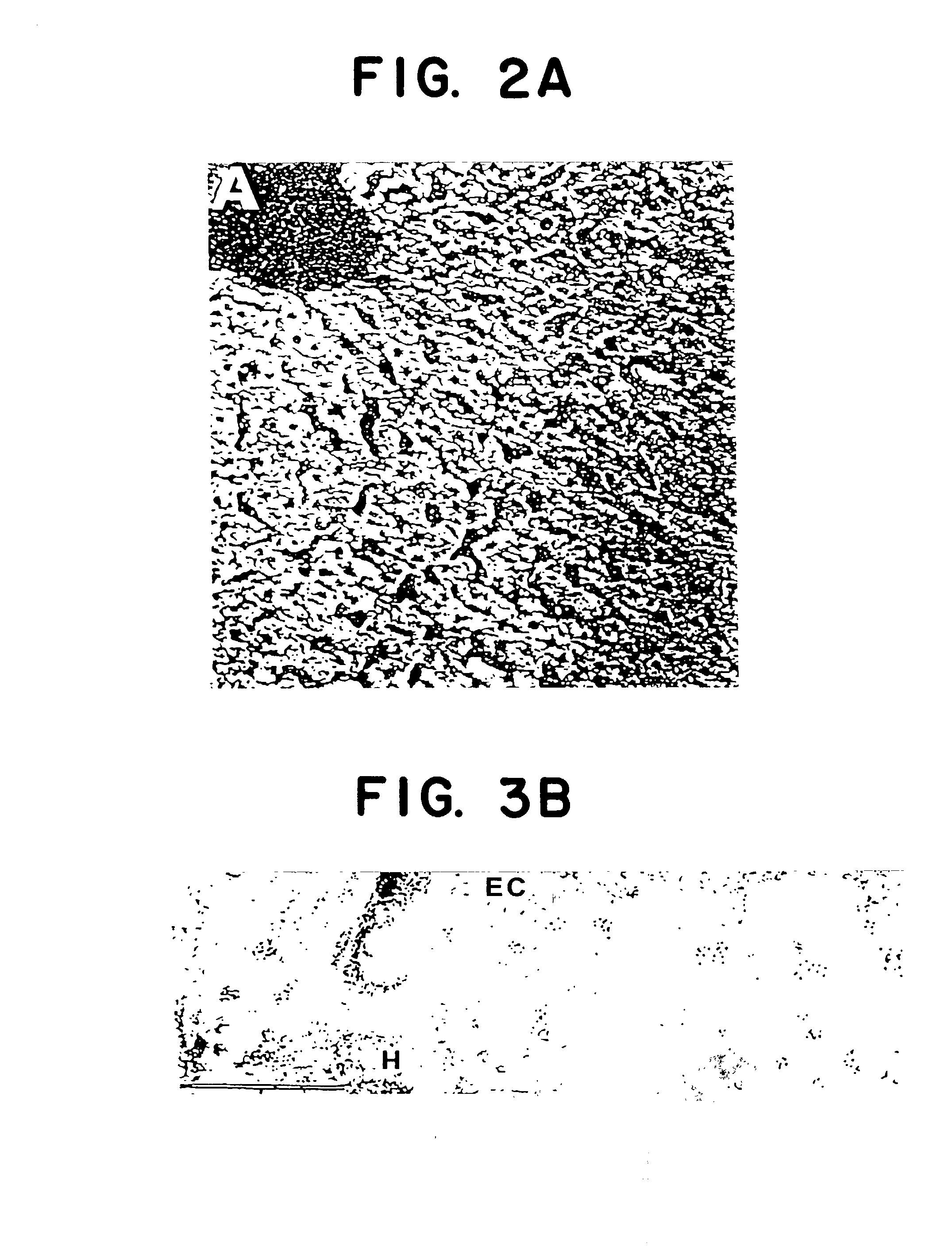 Compositions and methods for inhibiting hepatocyte invasion by malarial sporozoites