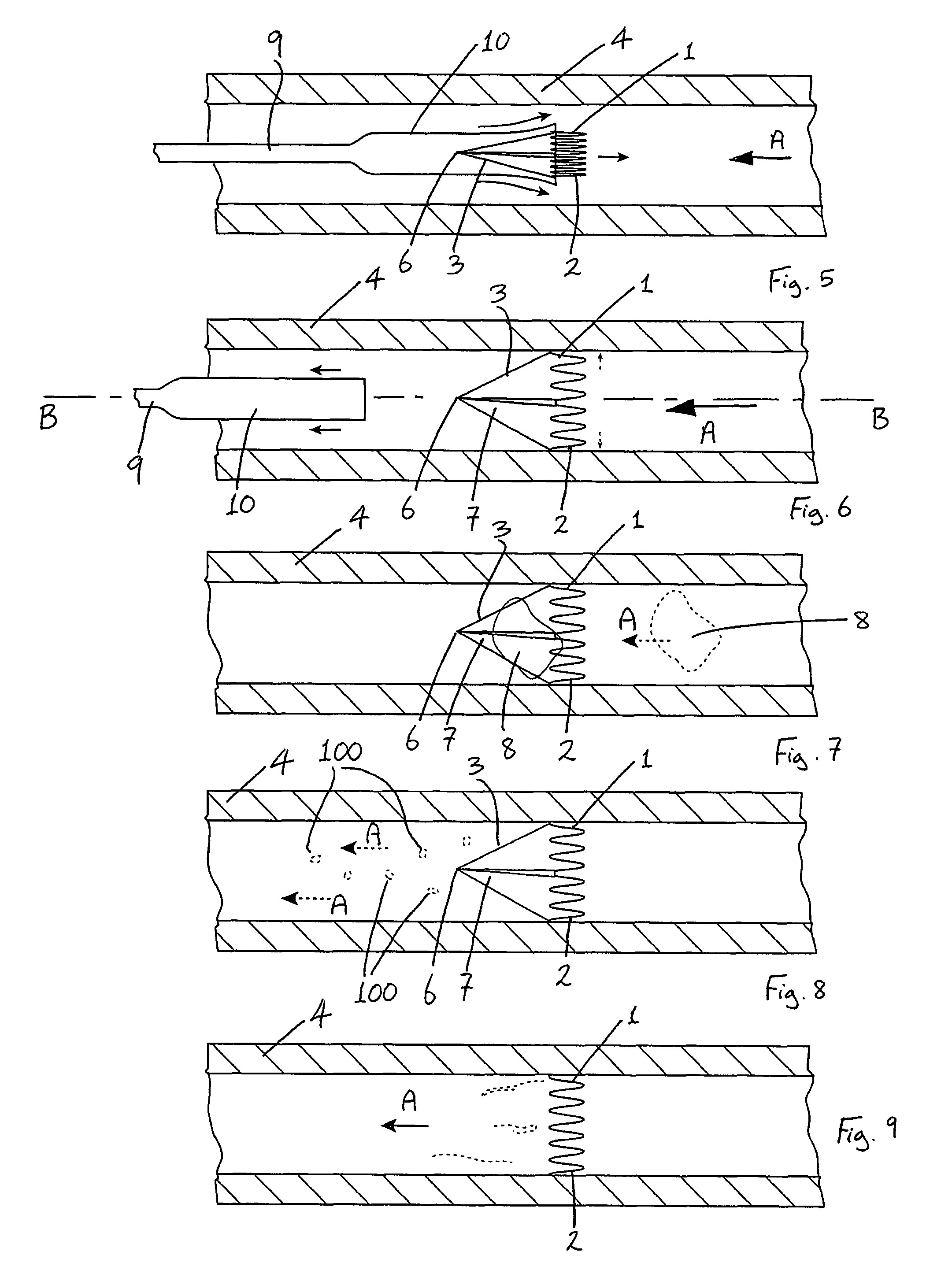 Vascular filter