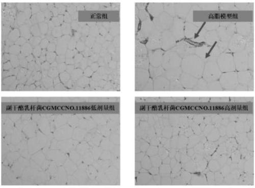 Lactobacillus rhamnosus with hyperlipidemia inhibiting effect and application of lactobacillus rhamnosus