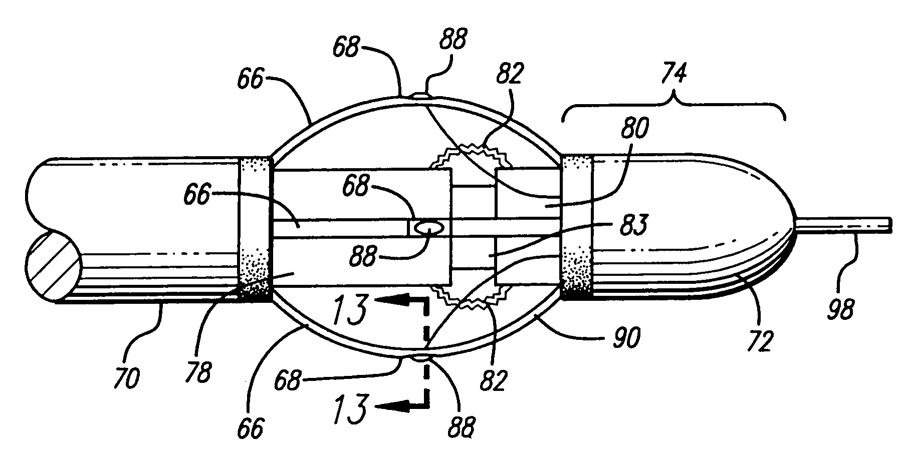 Apparatus for treating venous insufficiency using directionally applied energy