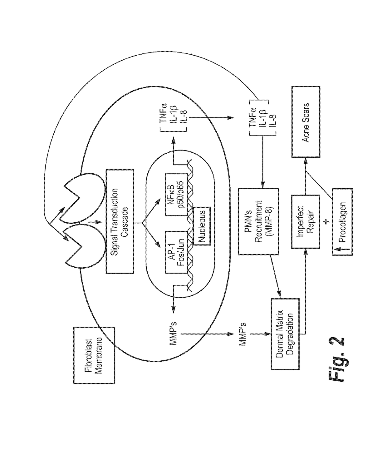 Semi-solid topical composition containing pirfenidone and modified diallyl disulfide oxide (M-DDO) for eliminating or preventing acne