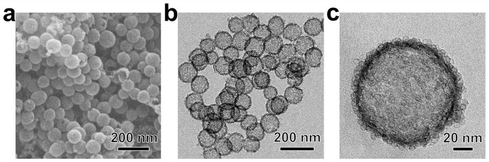 A kind of msnas-tpp multifunctional nanoparticle and its preparation method and application