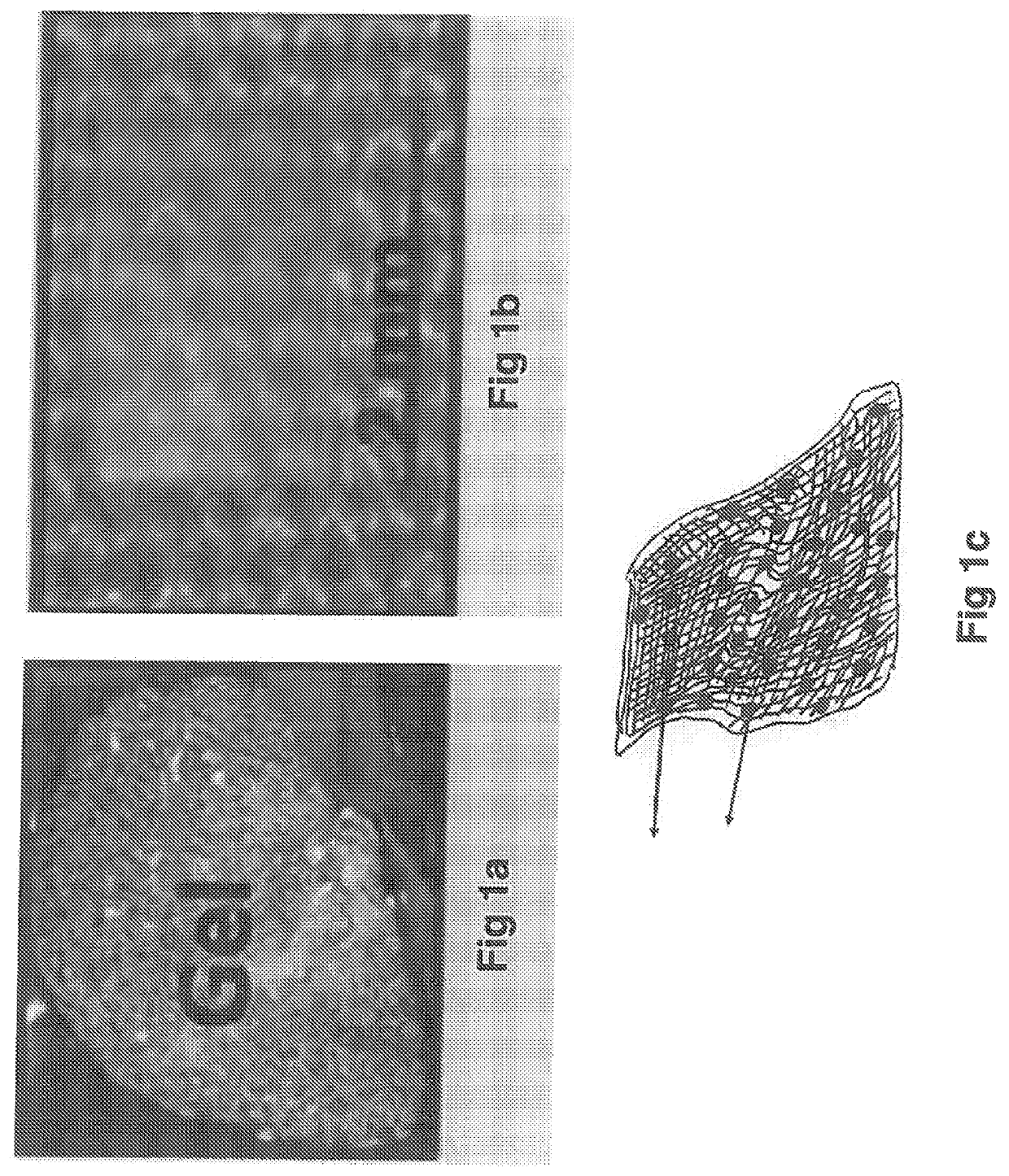 Drug eluting stent