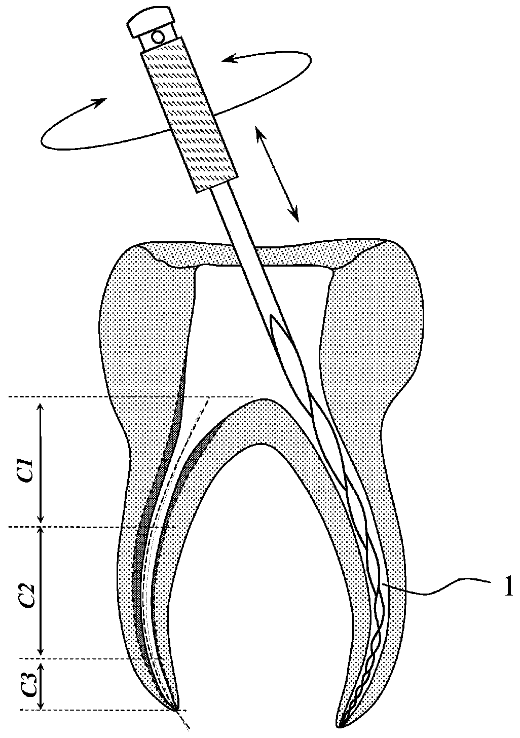 A kind of nickel-titanium alloy gradient flexible root canal file and its manufacturing method