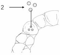 Invisible device for pressing down anterior teeth, rising posterior teeth and opening occlusion in invisible correction process