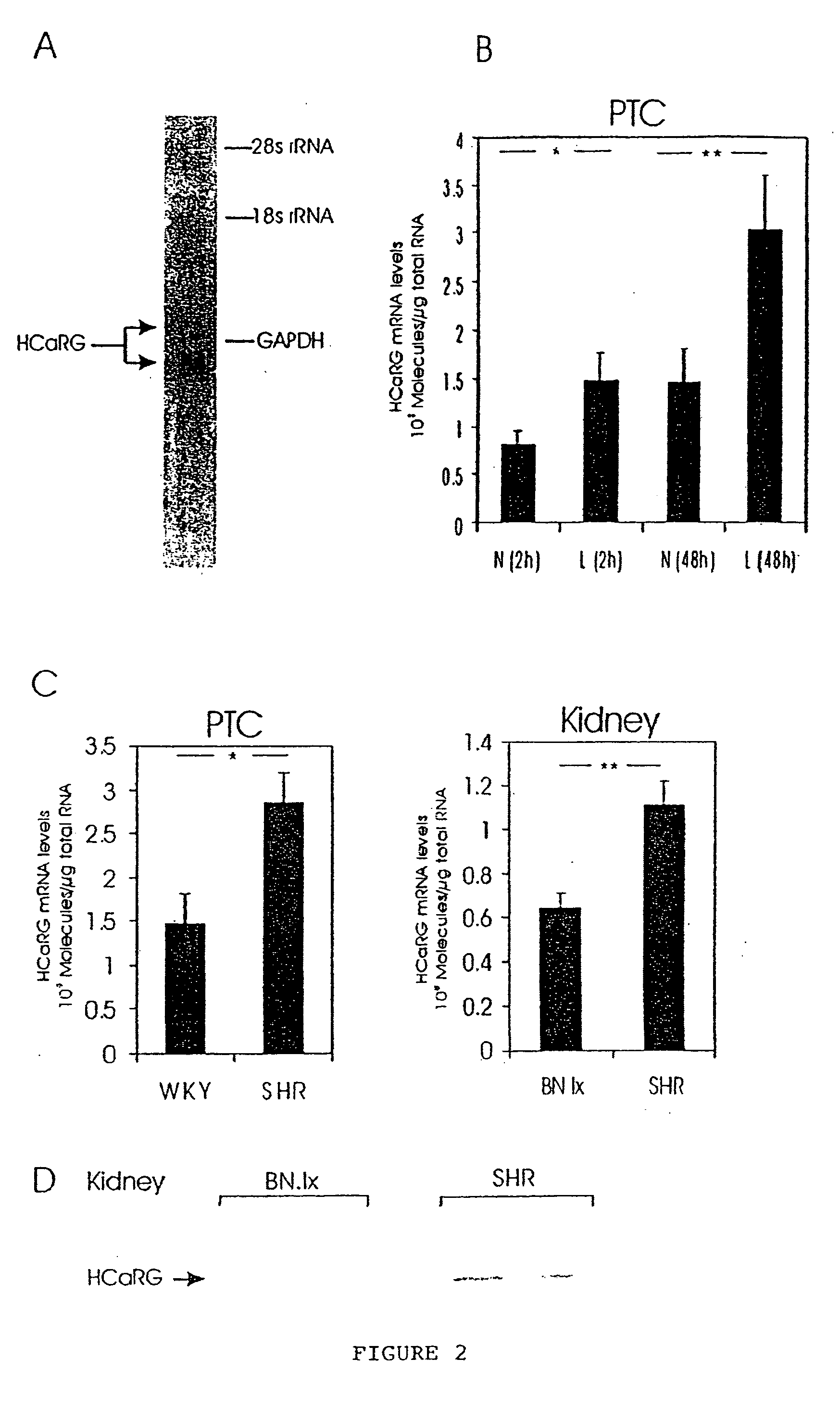 HCaRG, a novel calcium-regulated gene coding for a nuclear protein