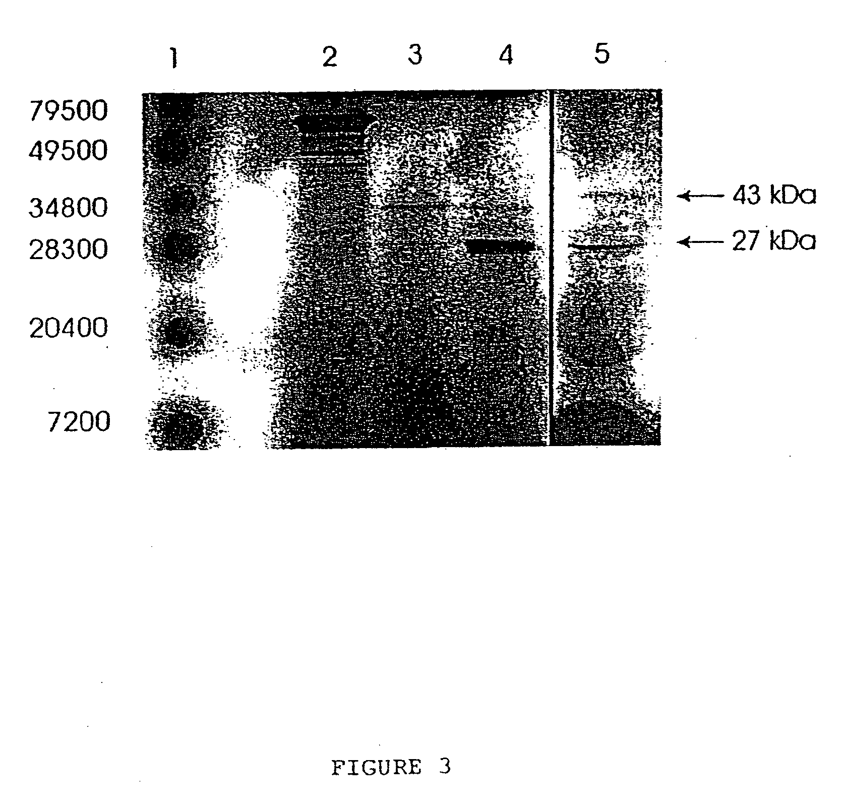 HCaRG, a novel calcium-regulated gene coding for a nuclear protein