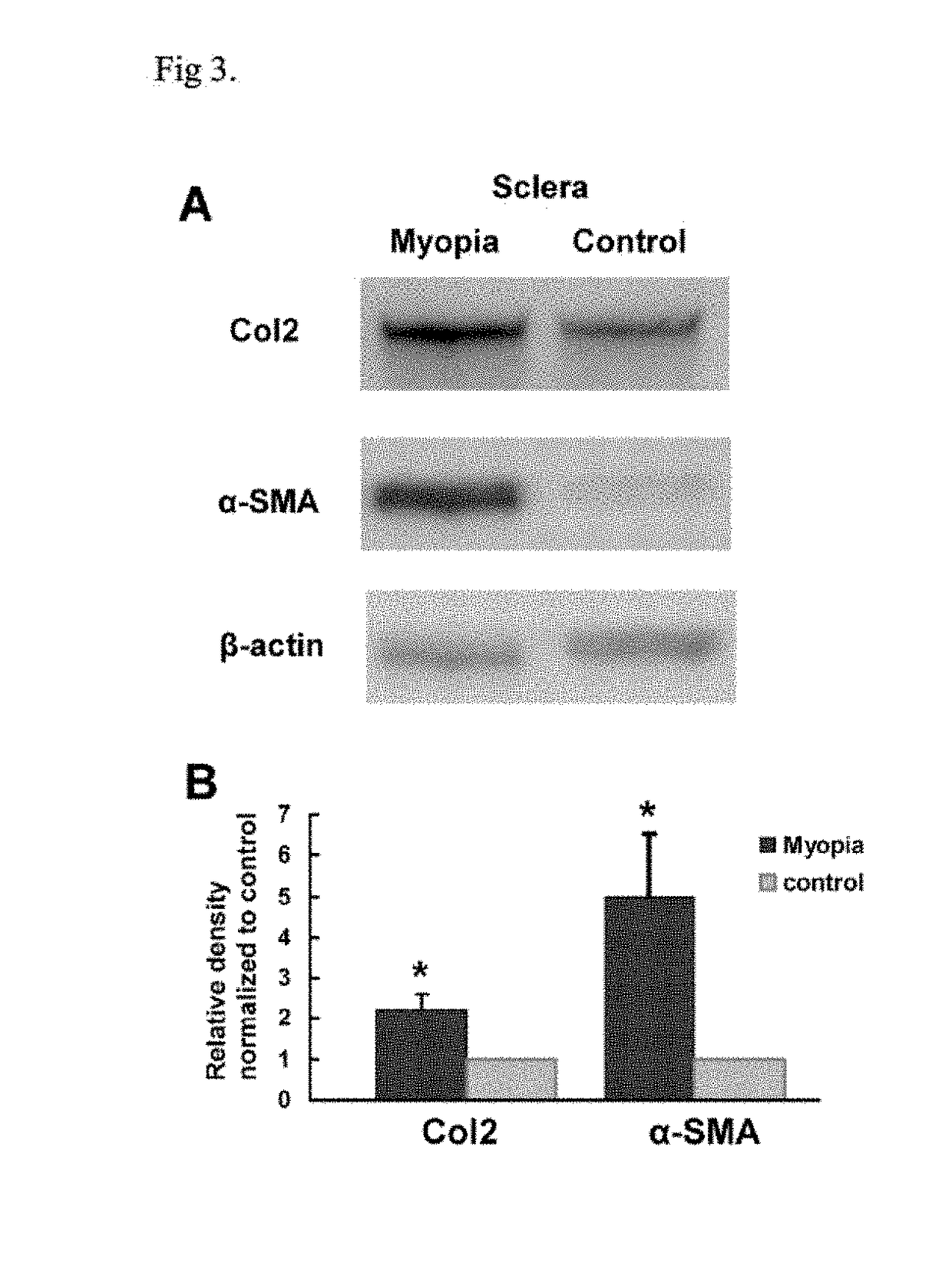 Pharmaceutical composition and uses thereof