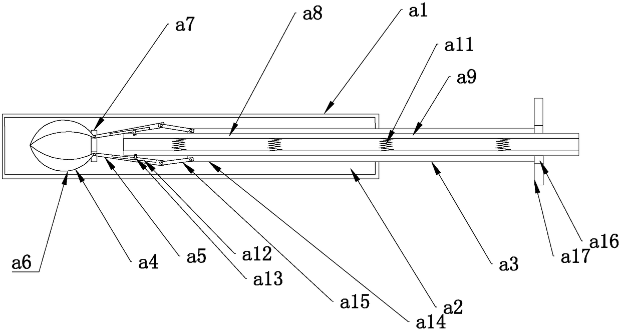 Intrahepatic stone extractor