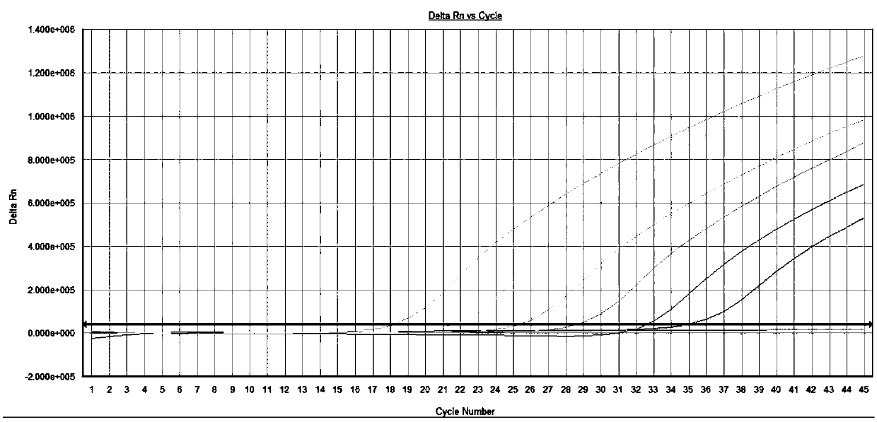 A kit for detecting Golgi protein 73 (GP73) mRNA (messenger Ribonucleic Acid) by a fluorescent quantitative PCR (Polymerase Chain Reaction) method