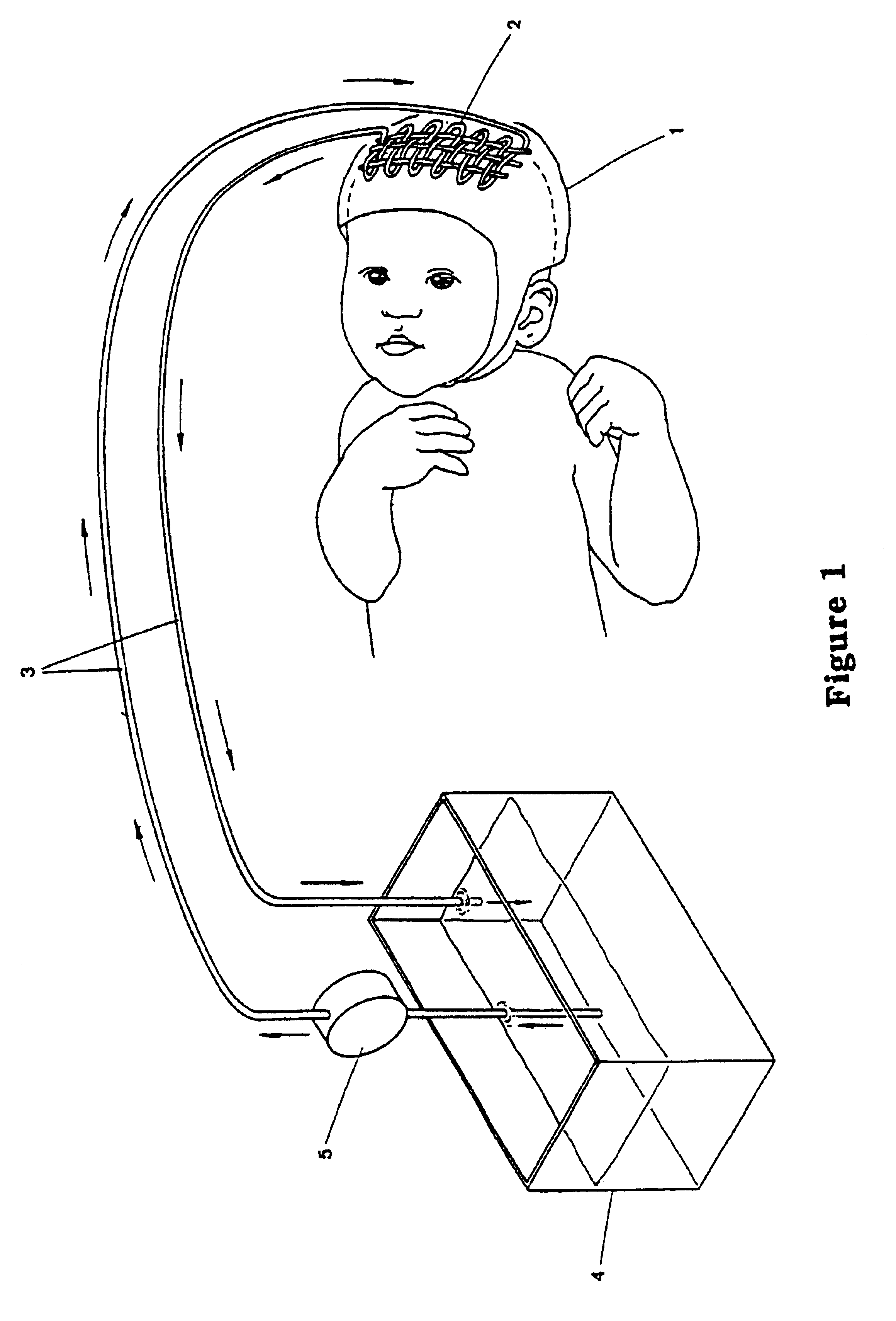 System method for reducing brain injury particularly in newborn infants