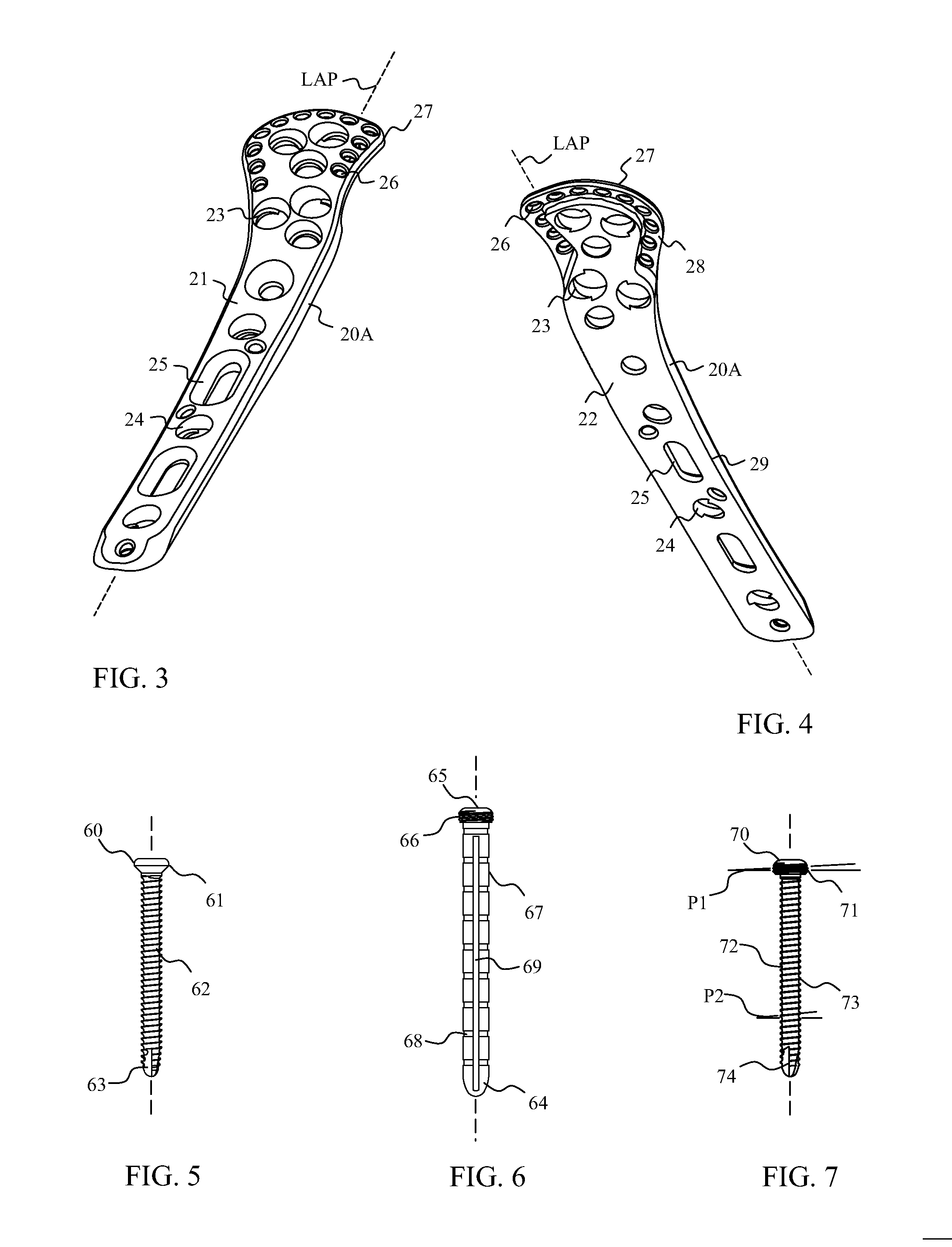 Proximal humerus fracture repair plate and system