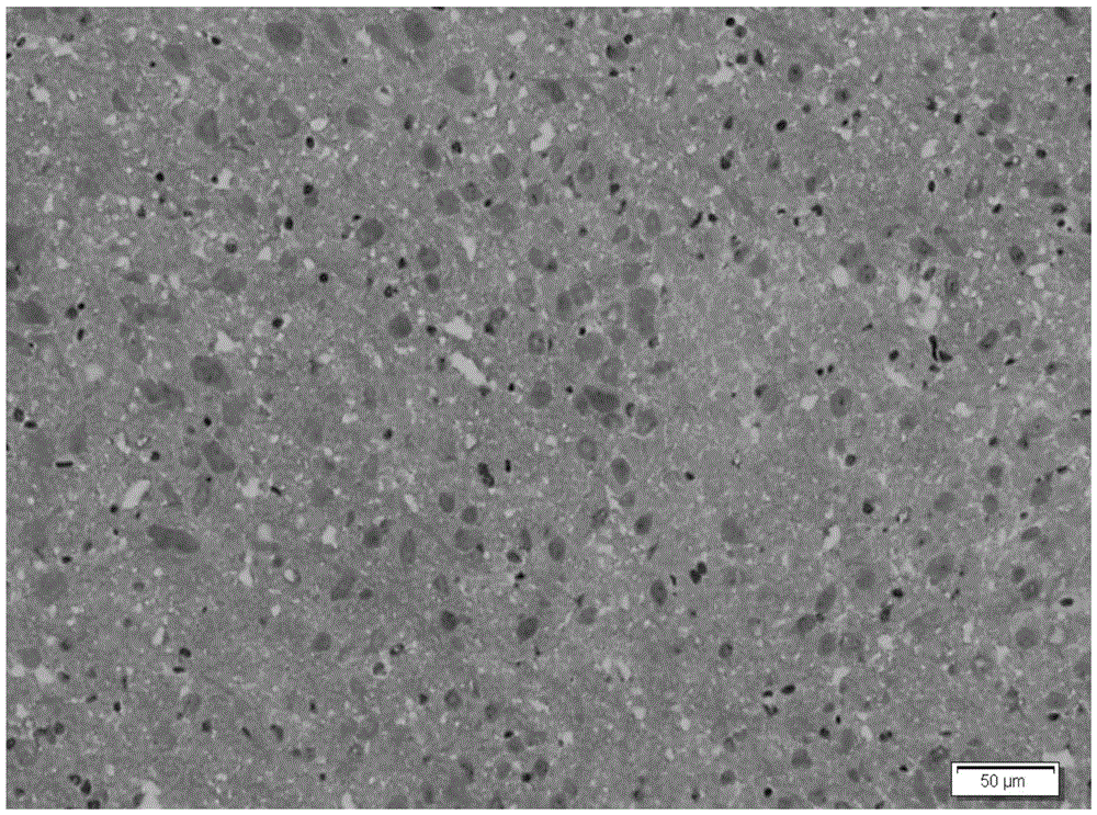 A kind of preparation method of rapid frozen section of brain tissue