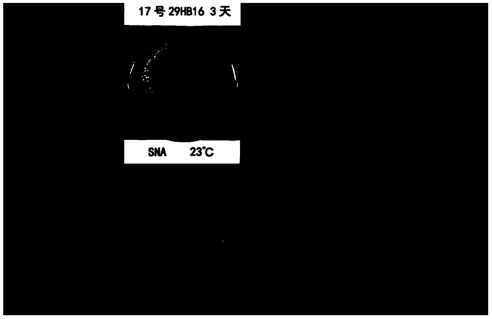 Saline-alkali tolerant trichoderma longibrachiatum and application thereof