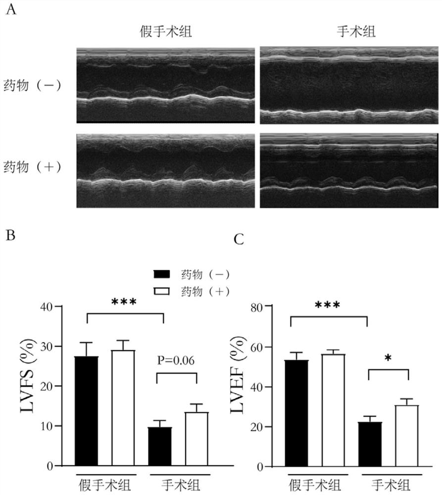 Application of bakuchiol in preparation of medicine for treating acute myocardial infarction