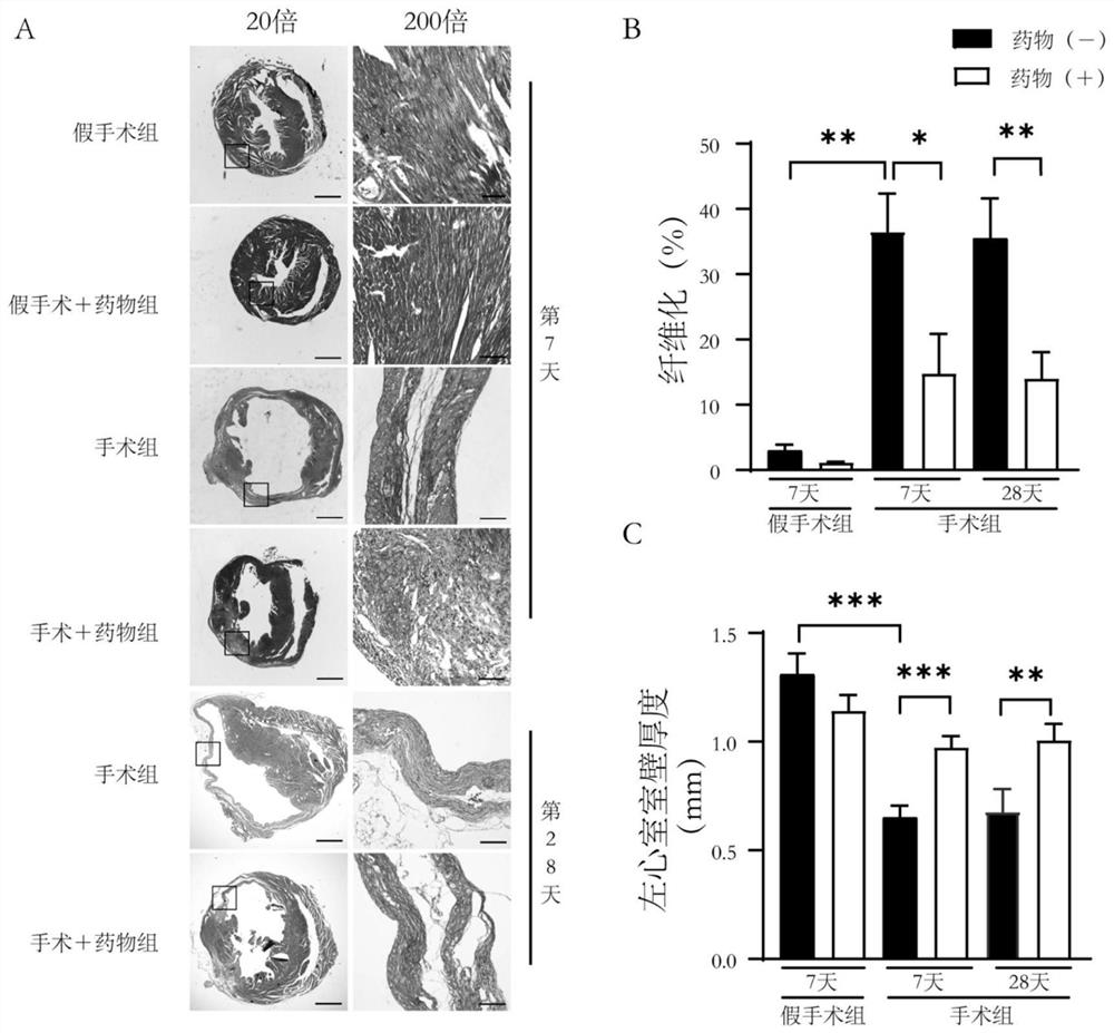 Application of bakuchiol in preparation of medicine for treating acute myocardial infarction