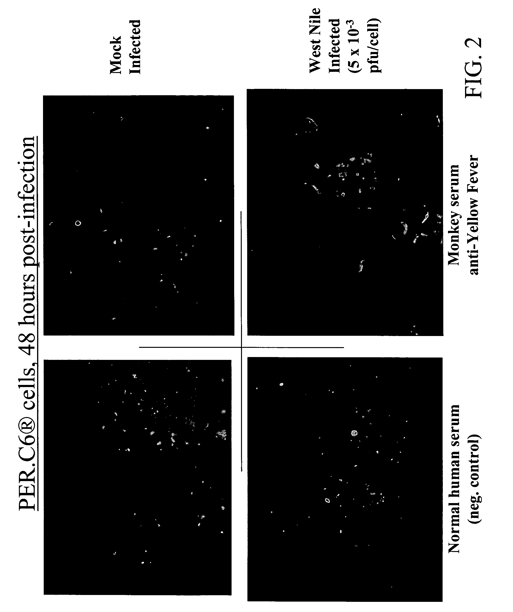 Vaccines against West Nile Virus