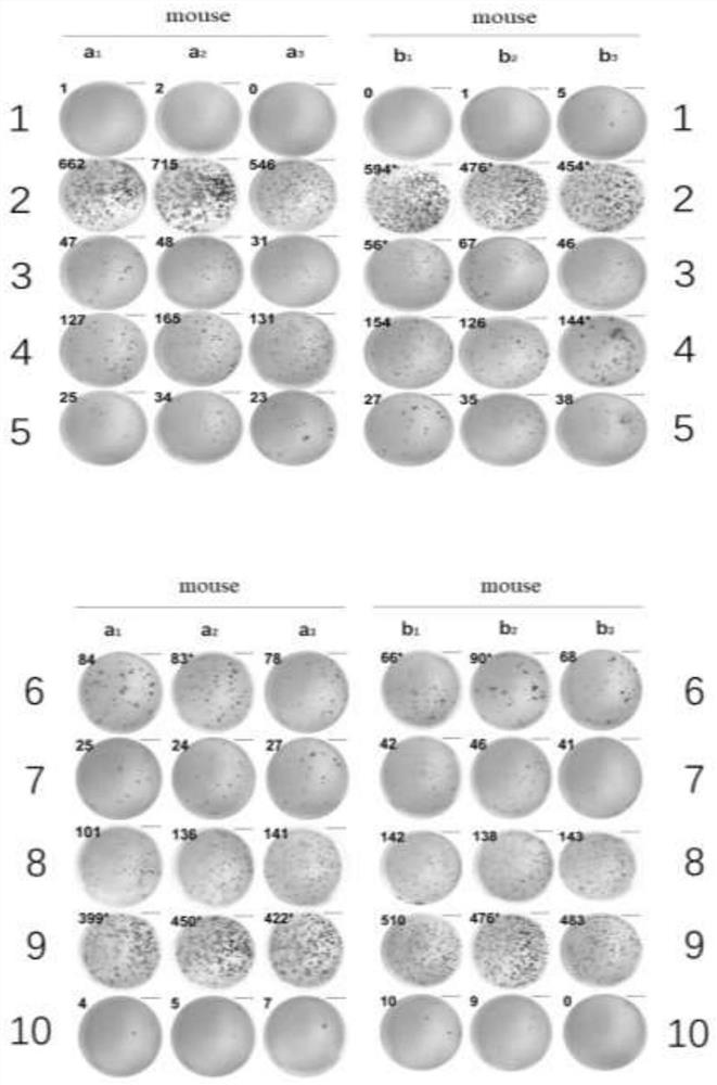 Universal polypeptide vaccine and its application in the preparation of drugs for treating/preventing pancreatic cancer