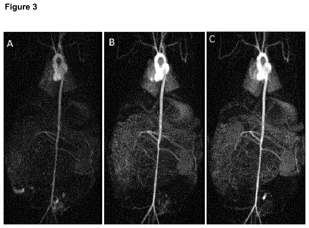 High relaxivity gadolinium chelate compounds for use in magnetic resonance imaging