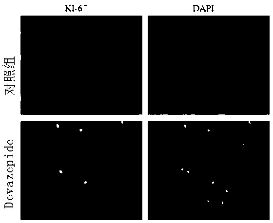 Application of cholecystokinin receptor inhibitor-Devazepide in preparation of anti-fibrosis pharmaceutical preparations