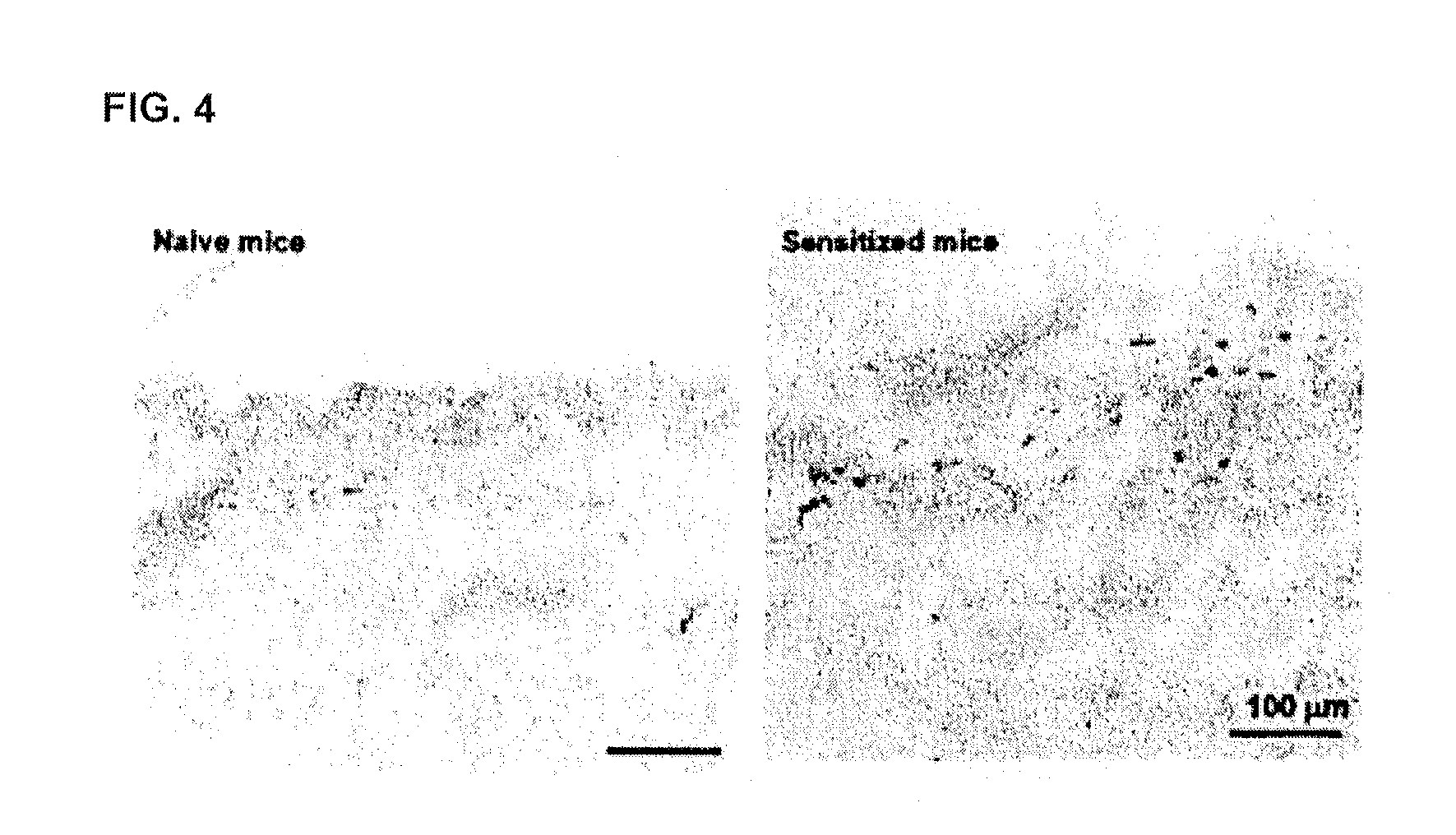 Biomarker of allergic disease and use of the same