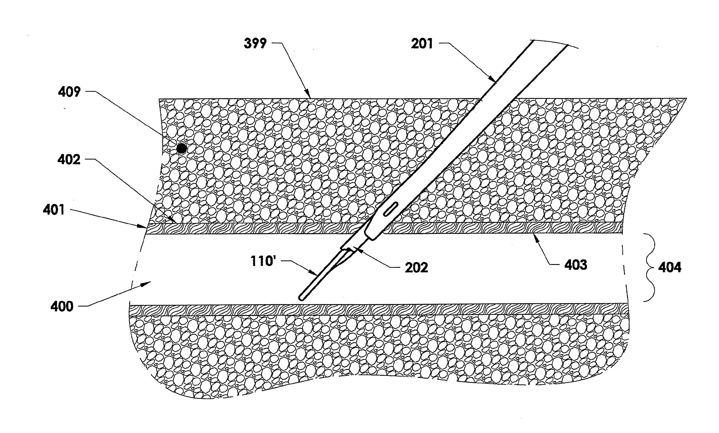 Closure Device, Deployment Apparatus, and Method of Deploying a Closure Device