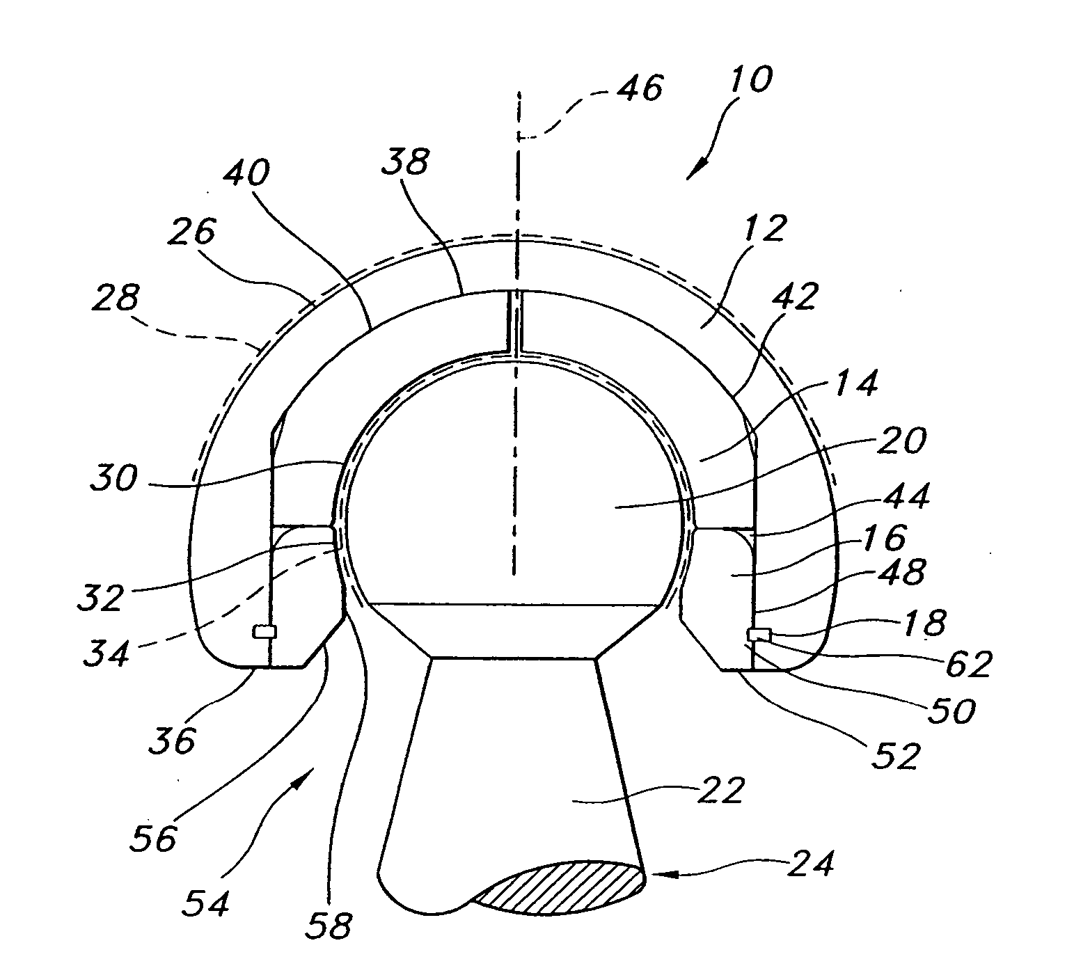 Hip prostheses