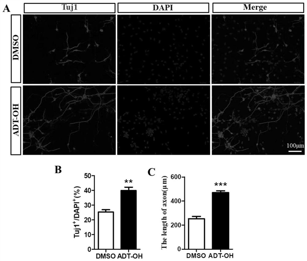 Application of hydrogen sulfide slow-release organic donor ADT-OH in preparation of medicine for treating nervous system diseases