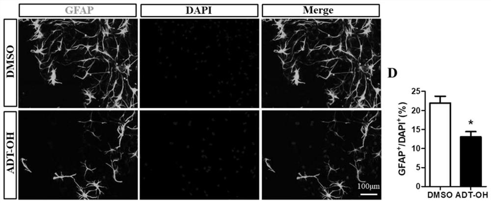 Application of hydrogen sulfide slow-release organic donor ADT-OH in preparation of medicine for treating nervous system diseases