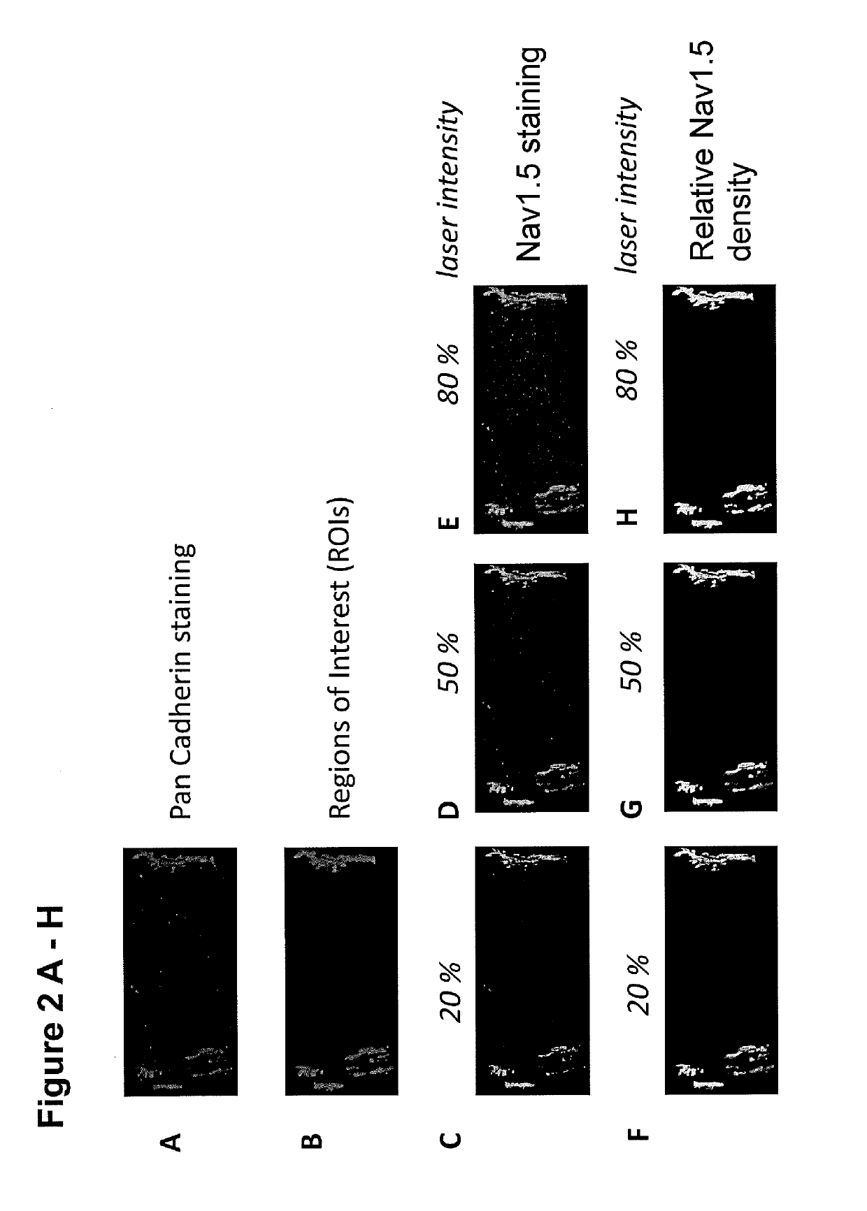 Method and kit for assessment of sodium channel-related anti- or pro-arrhythmic potential of compounds