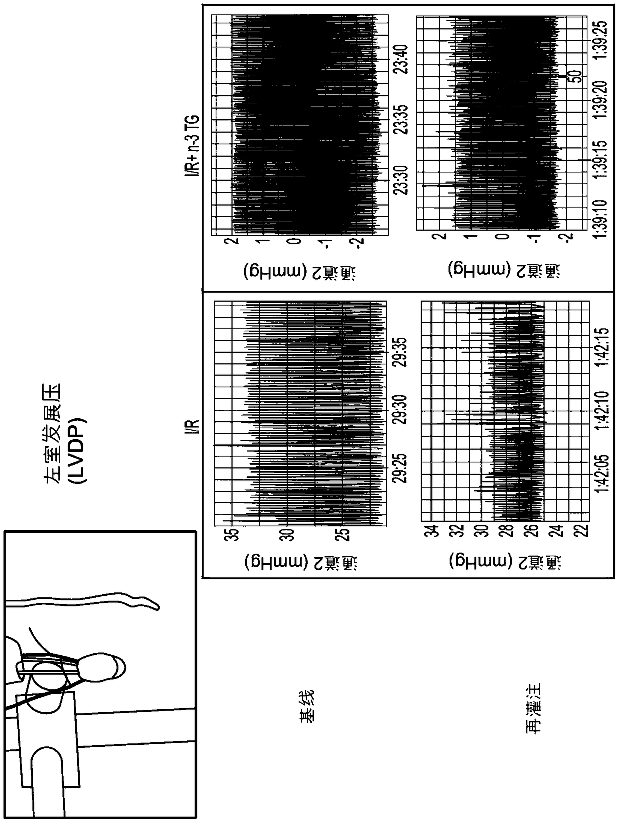 Reperfusion with omega-3 glycerides promotes protection of donor organs for transplantation