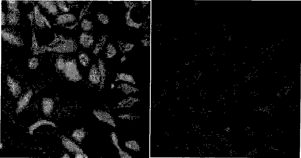 Cryptosporidum parvum bivalent nucleic acid vaccine and preparation method thereof