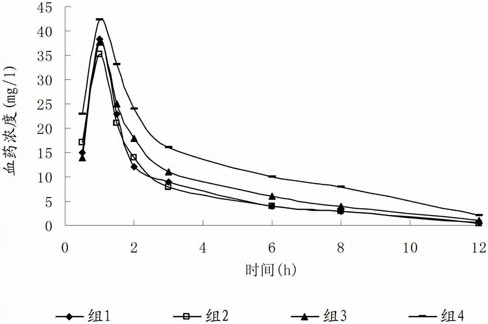 Pharmaceutical composition of injection ceftizoxime sodium and compound amino acid injection