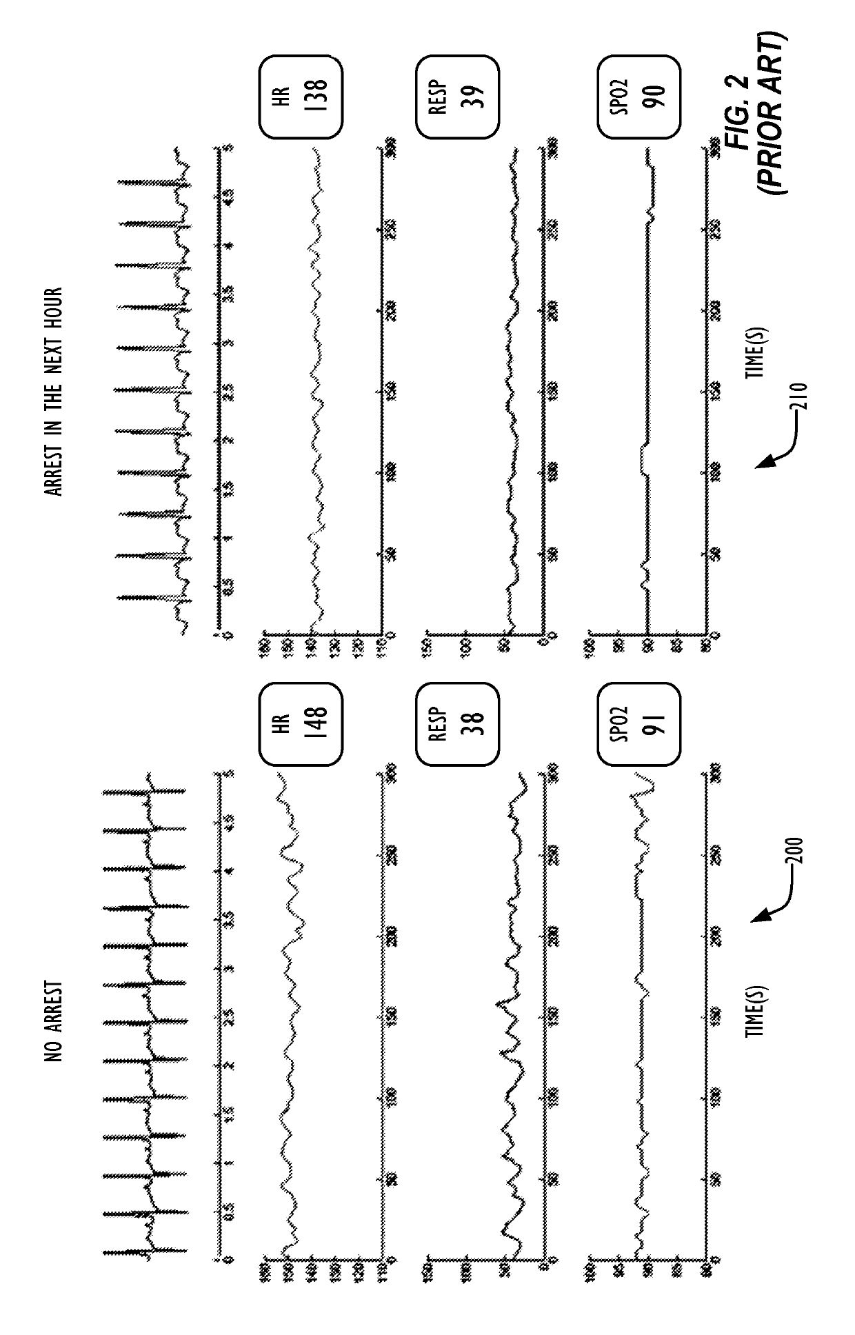 Clinical metric for predicting onset of cardiorespiratory deterioration in patients