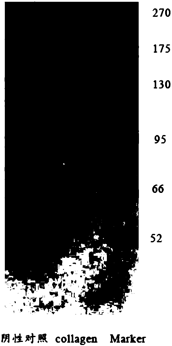 Detection method of collagen terminal peptide