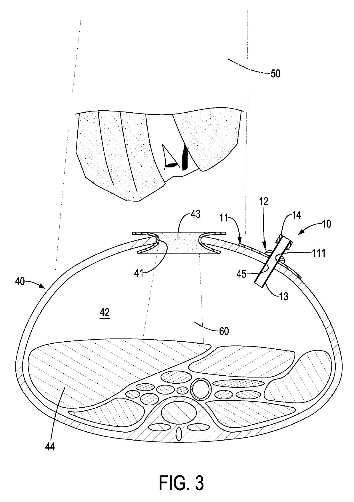 Body cavity illumination apparatus