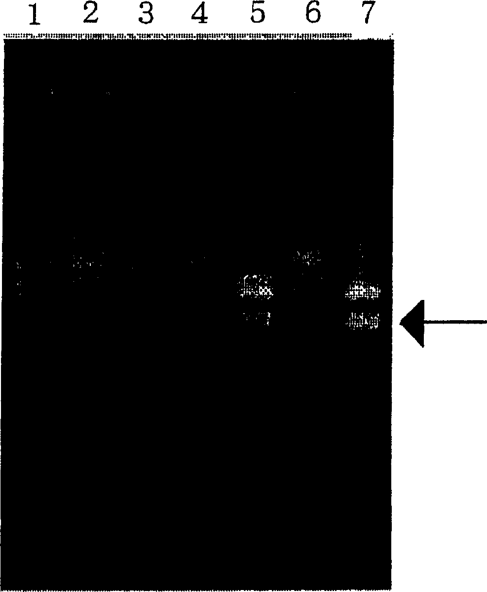 Method of typing gene polymorphisms