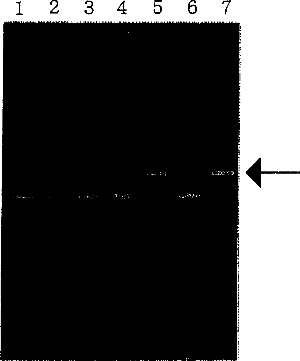 Method of typing gene polymorphisms