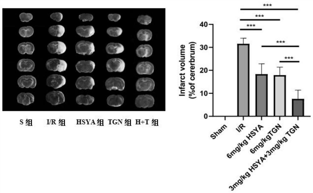 Application of composition of hydroxysafflor yellow A and tenuigenin in preparation of medicine for treating cerebral arterial thrombosis