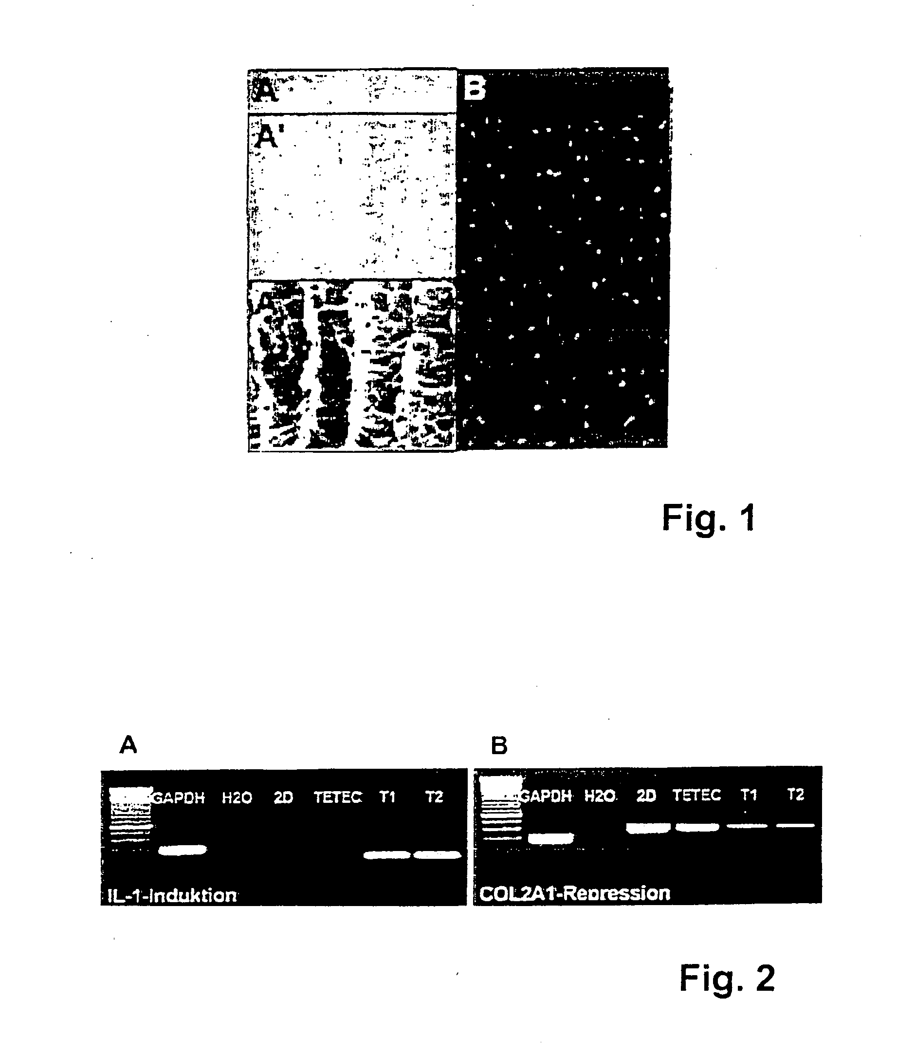 Implant for repairing a cartilage defect