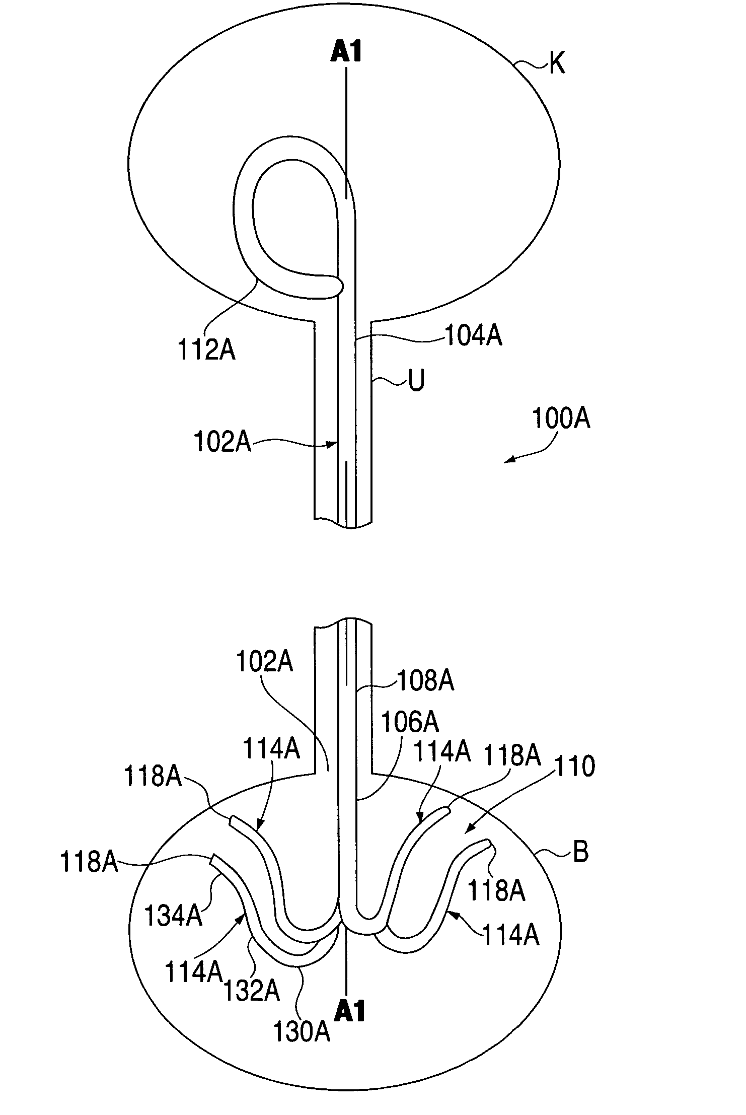 Ureteral stent with conforming retention structure