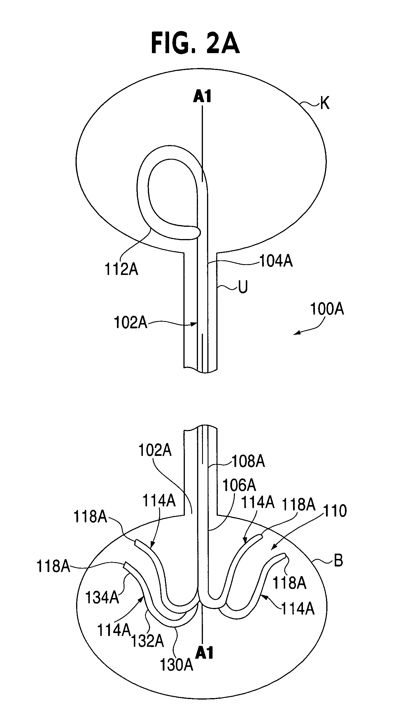 Ureteral stent with conforming retention structure