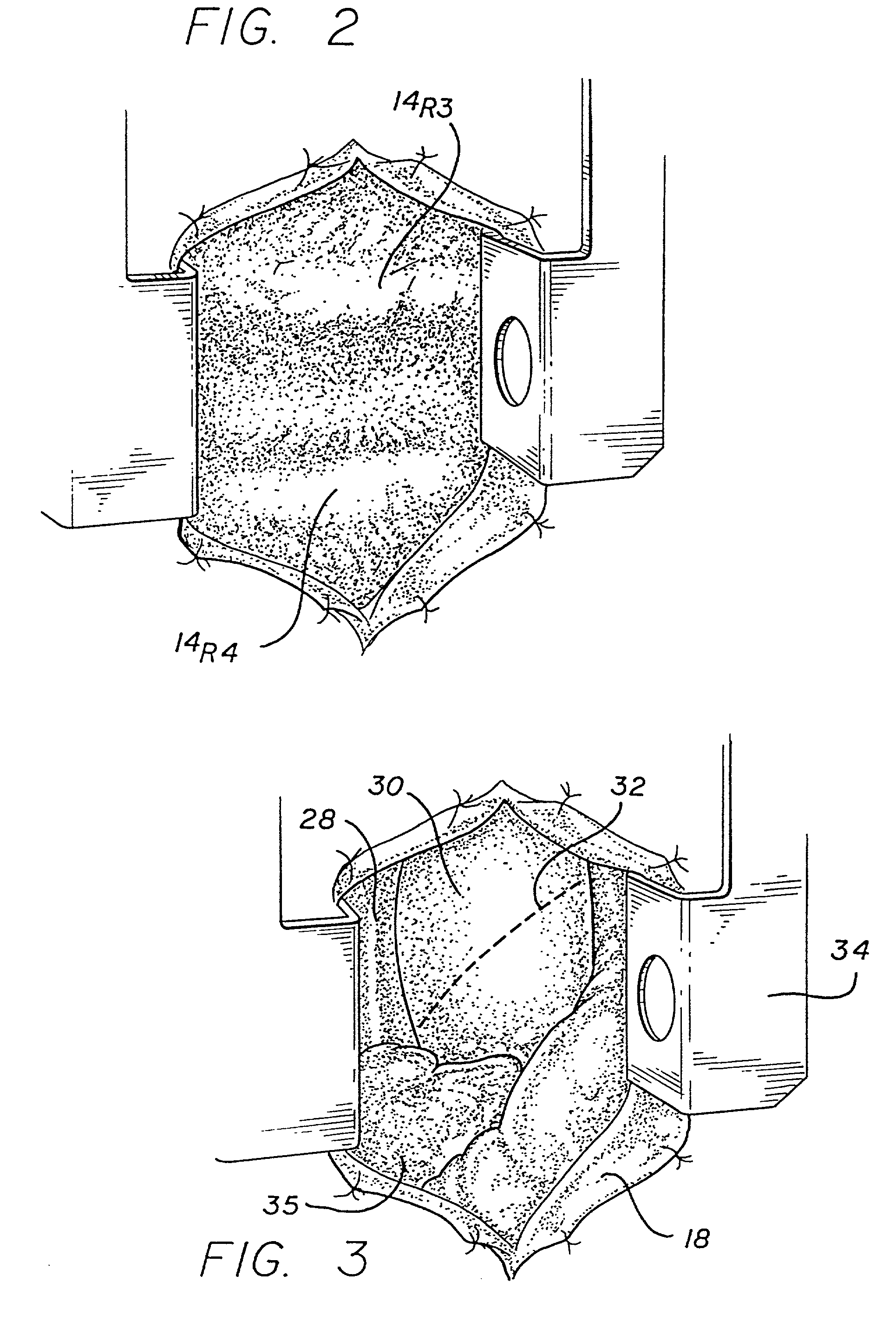 Minimally invasive cardiac surgery procedure