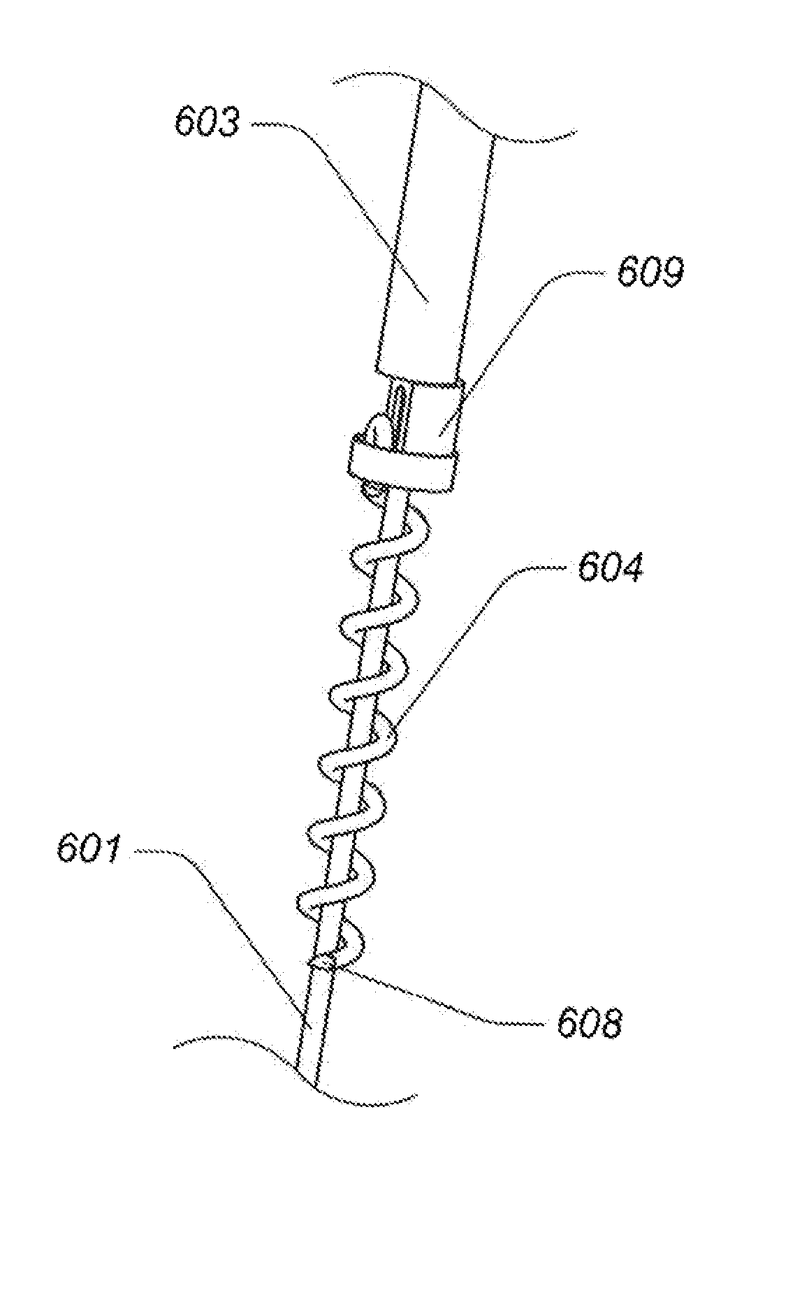 Tissue anchor system