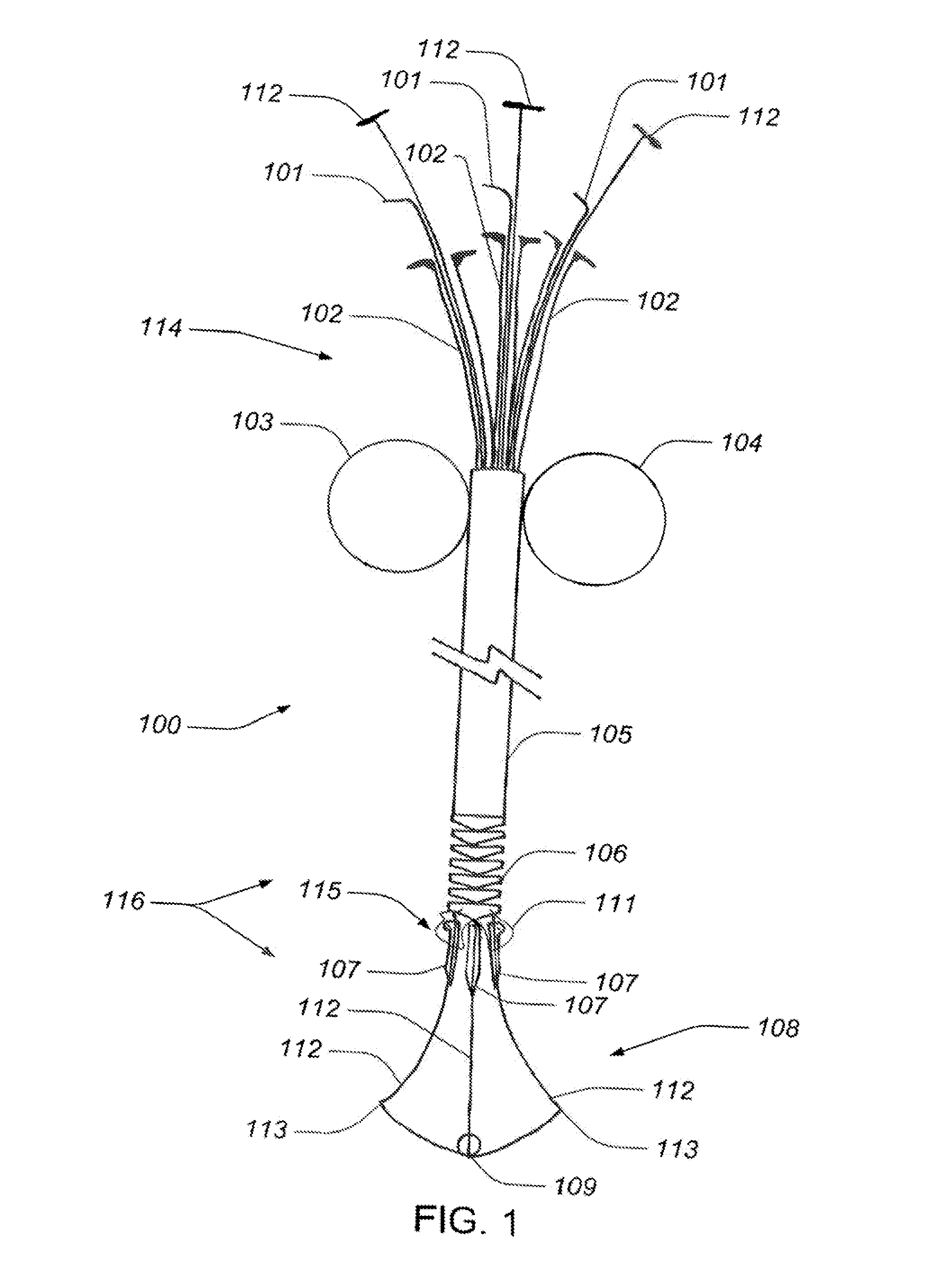 Tissue anchor system