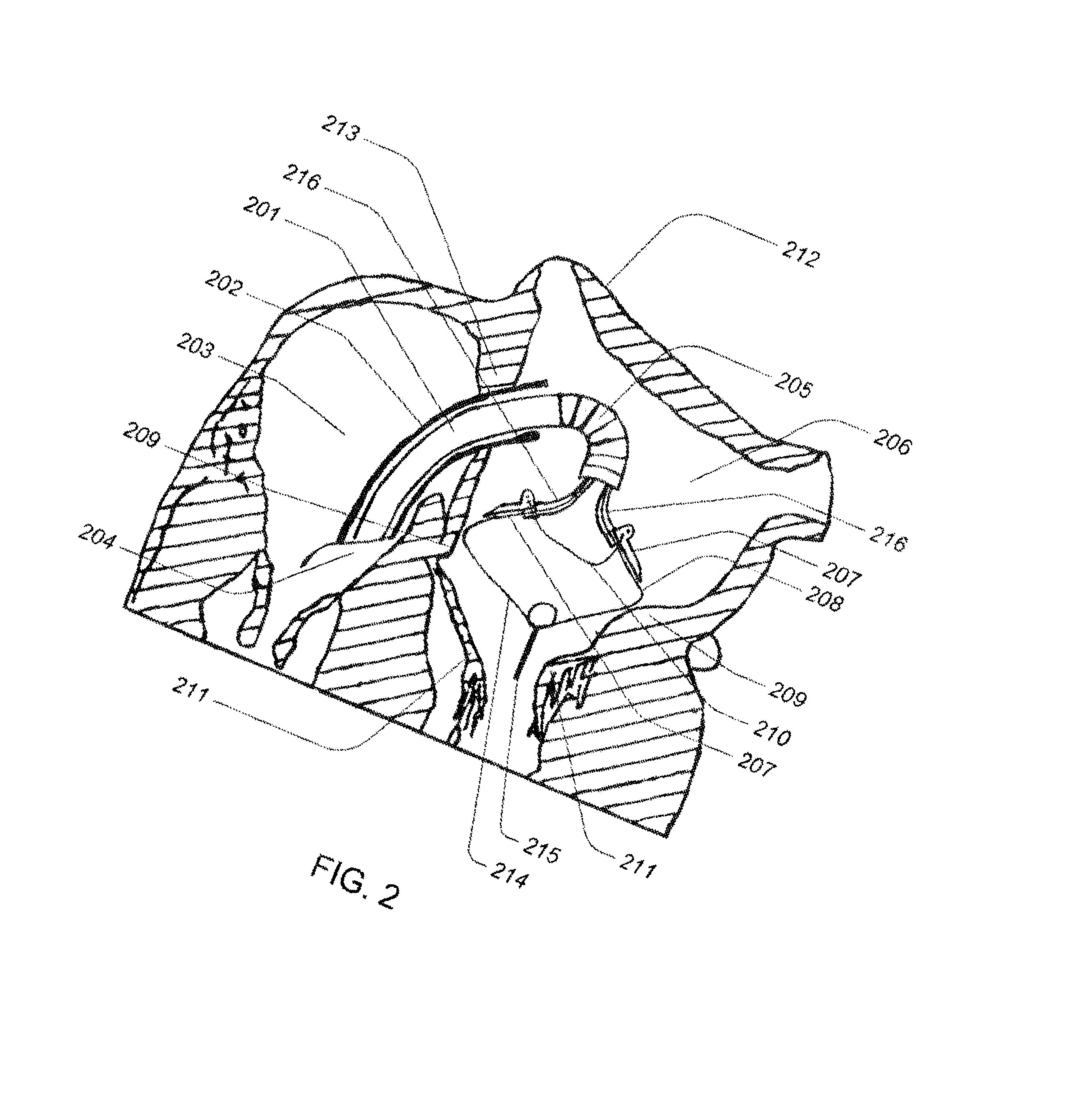 Tissue anchor system